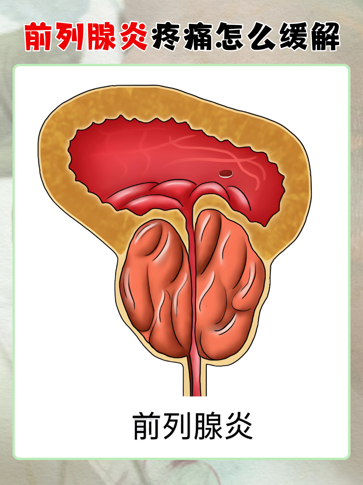前列腺论坛手机版(前列腺论坛为什么关闭)-第1张图片-QuickQ官网